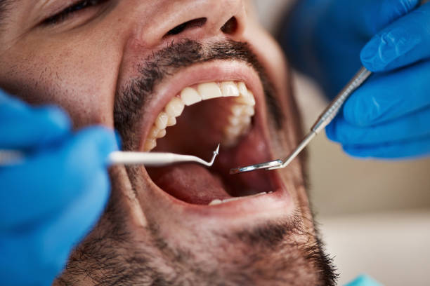 Best Mobile Emergency Dentist in White Meadow Lake, NJ