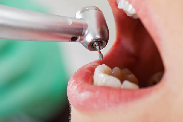 Best Emergency Dental Services for Seniors in White Meadow Lake, NJ